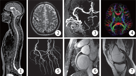 1. Systemic spinal nerve image, 2. Cerebral artery diagnostic image, 3. Cerebral artery vascular diagnostic image, 4. Anisotropic diffusion-weighted image, 5. Wrist vascular diagnostic image, 6. Coronary artery diagnostic image, 7. Knee joint diagnostic image
