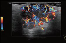Chest lesion imaging Image